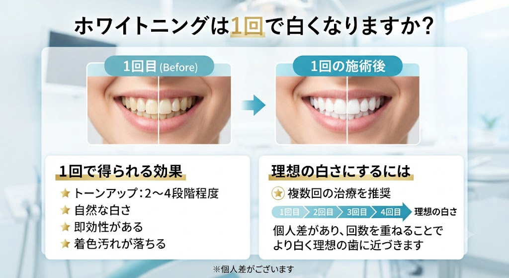 ホワイトニングは何回で白くなる？1回の施術で期待できる効果と、理想の白さを目指すための回数の目安を紹介した比較画像。